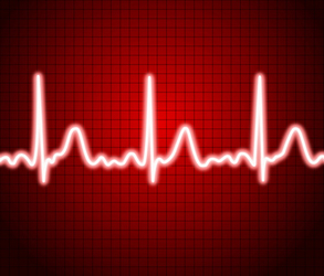 image of a cardiogram measuring heart rate